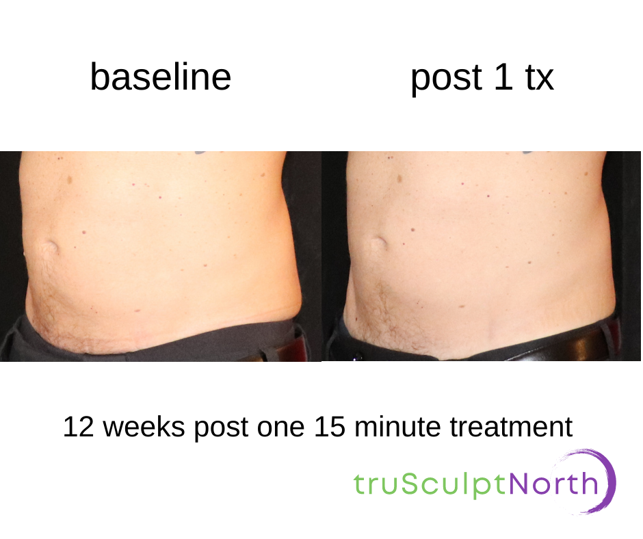 Larry R Feb use B&A1.png