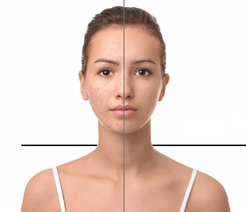 Deep Cleansing Facial
