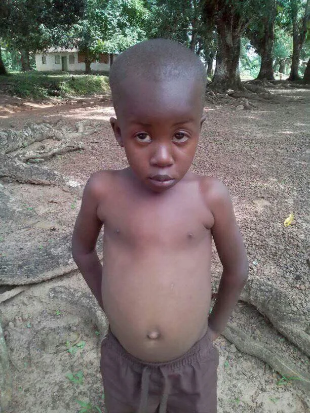 E-man prior to surgery