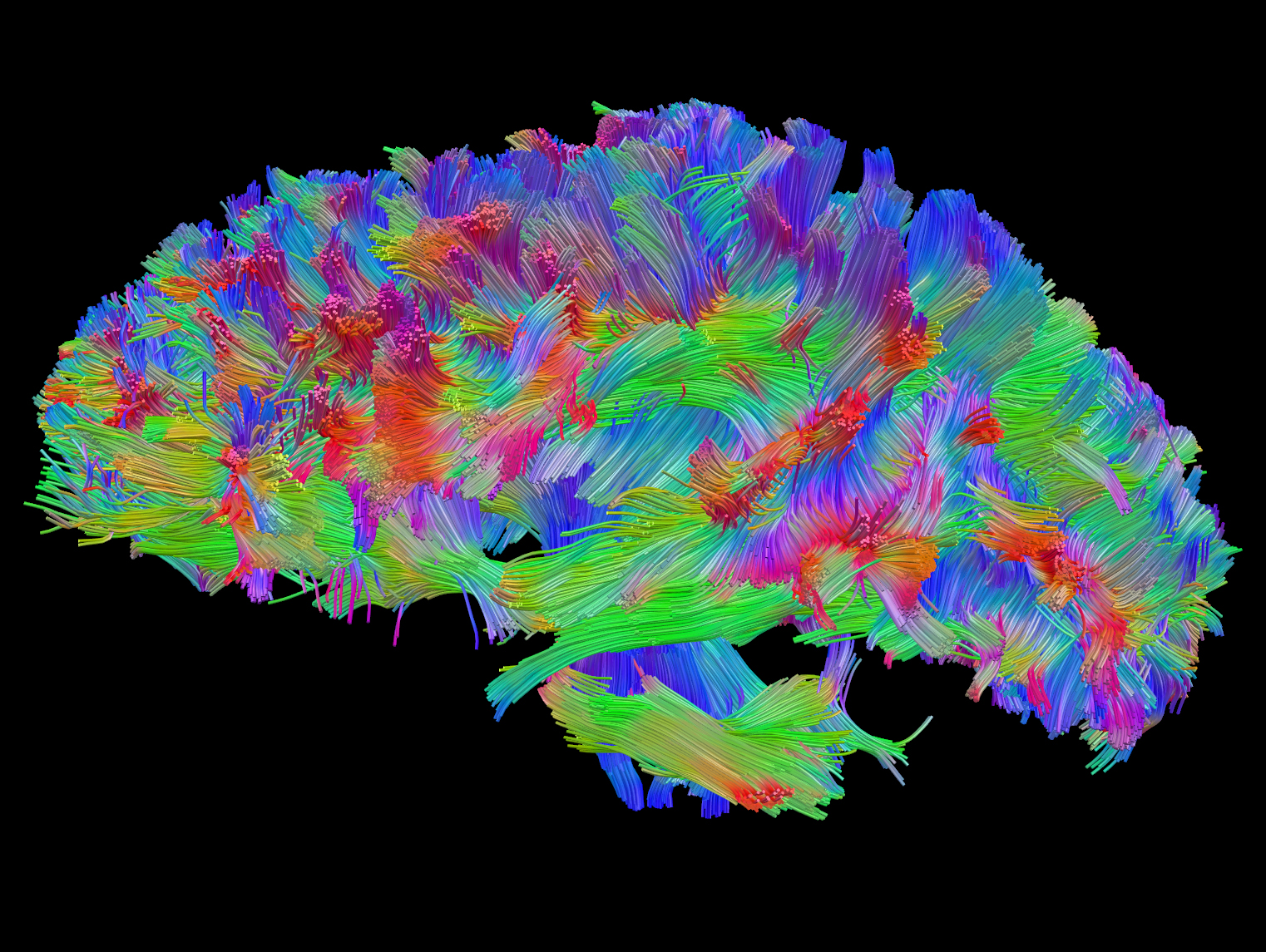 TBI-uninjured-left-side-WholeBrainSagRGB.jpg