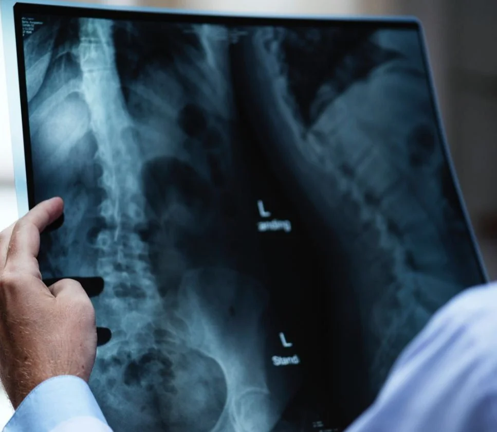 Xray snip (2) v2.jpg