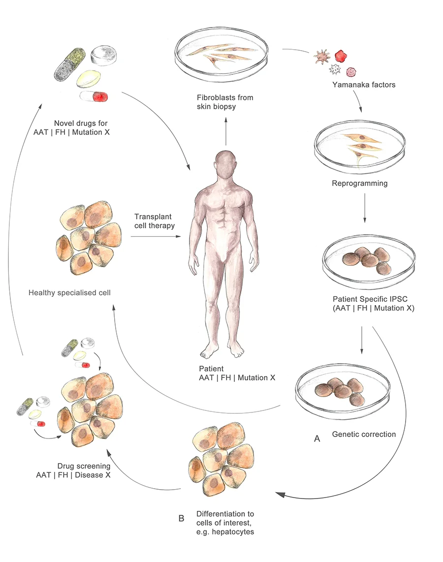 Figure 5: Using the patient's own skin cells, reprogrammed to develop patient-specific medicines, or transplanting fresh tissue to the patient with no rejection