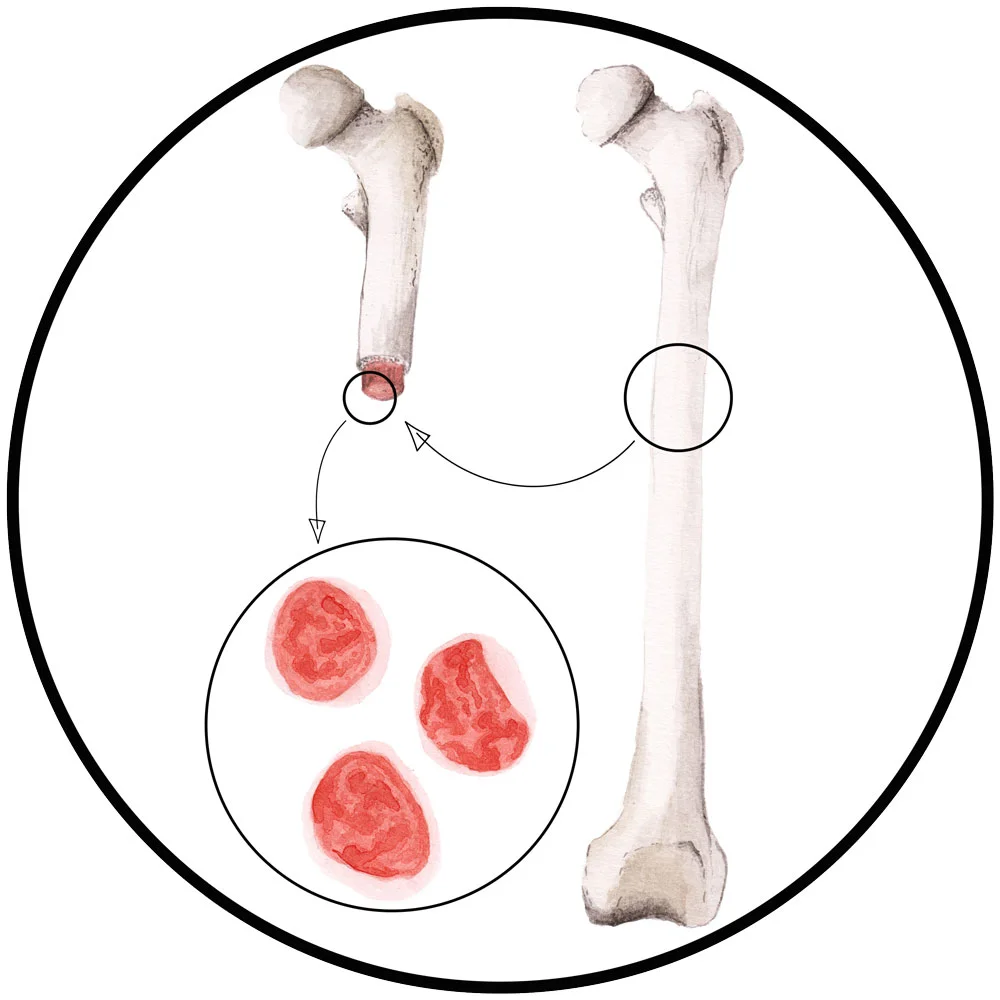 Haematopoeitic Stem Cells - click for BSL term