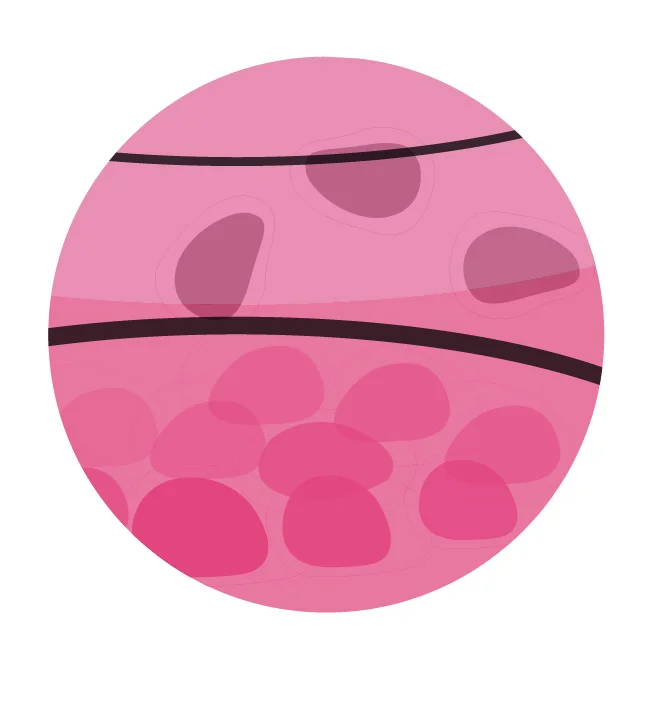 The attached vs floating (dead) cells once thawed and plated