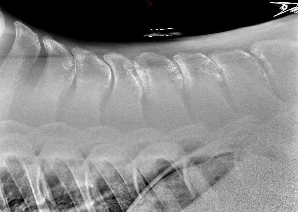 Emme malta lopettaa joulukalenteria, vaan keskustelusta inspiroituneina jatkamme selk&auml;aiheella viel&auml; toisen postauksen verran.

4. luukussa k&auml;siteltiin tutkimusta, jossa verrattiin sel&auml;n r&ouml;ntgenl&ouml;yd&ouml;ksi&auml; ja my&