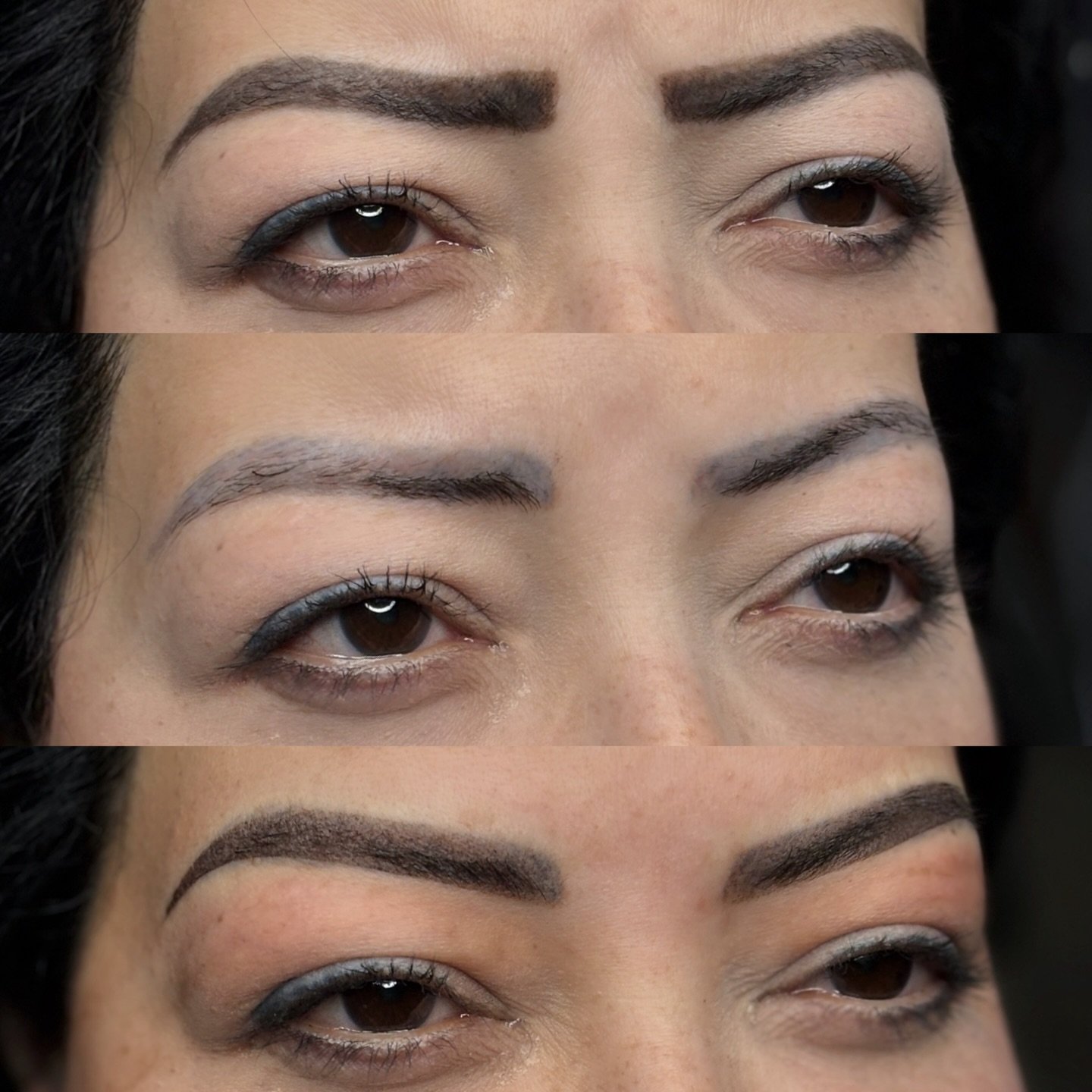 SWIPE &gt;&gt;&gt;

We see so many guests with various brow circumstances from previous work; dark, discolored, blotchy, scarred,  muddy.

Based on the specifics of the canvas, we follow whatever protocol we believe will achieve optimal results that 