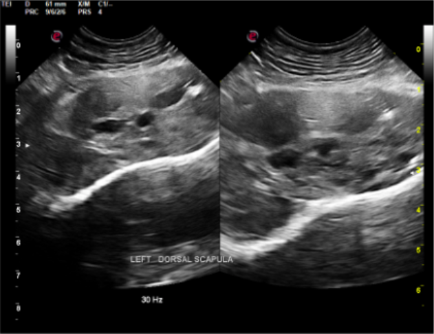 Ultrasound image of the mass using a high frequency linear probe.
