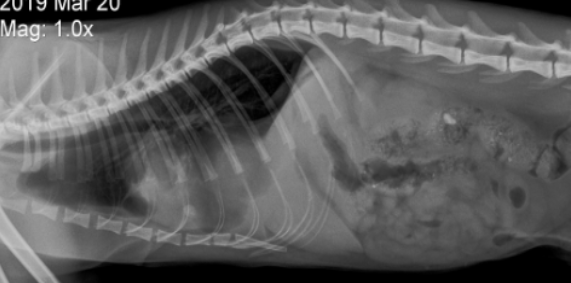 Image of this patient prior to surgical management. Mild pleural effusion is present with loss of the diaphragmatic line and loss of the cardiac silhouette.