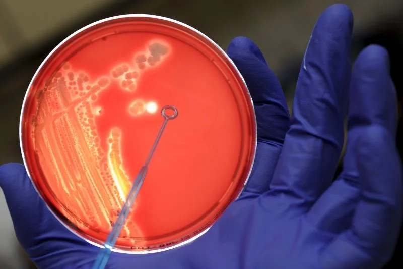 bcteria infection.jpg