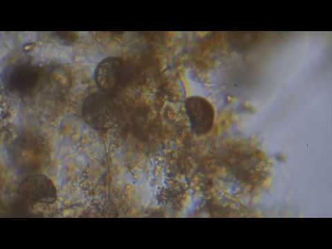 Huntley Meadows Shelled Amoebae