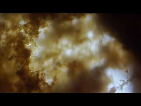 Huntley Meadows Vorticellae