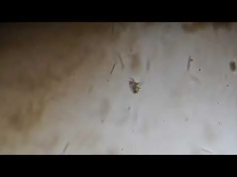 Huntley Meadows Nauplii