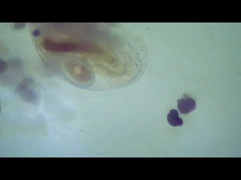 Kingstowne Pond Zooplankton 2