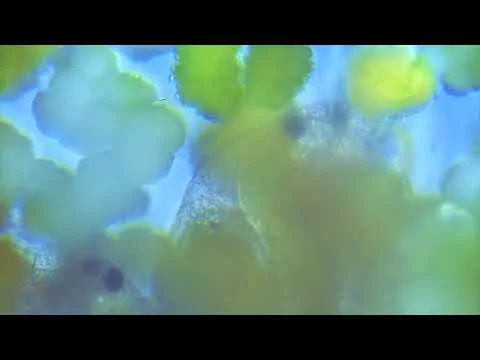 Kingstowne Pond Zooplankton