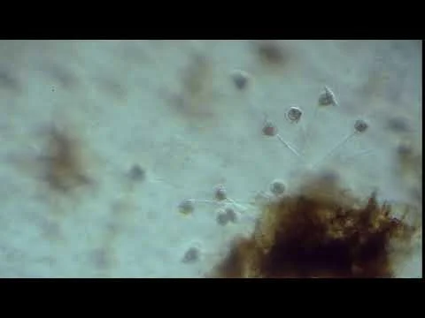 Vorticellae vs. Ostracod