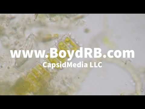 Macro Monday - New Orleans Water Under the Microscope