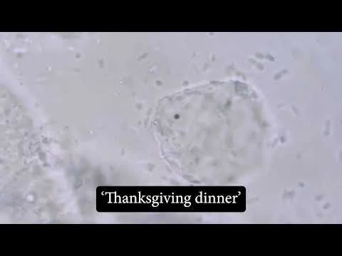 Raw Turkey Bacteria