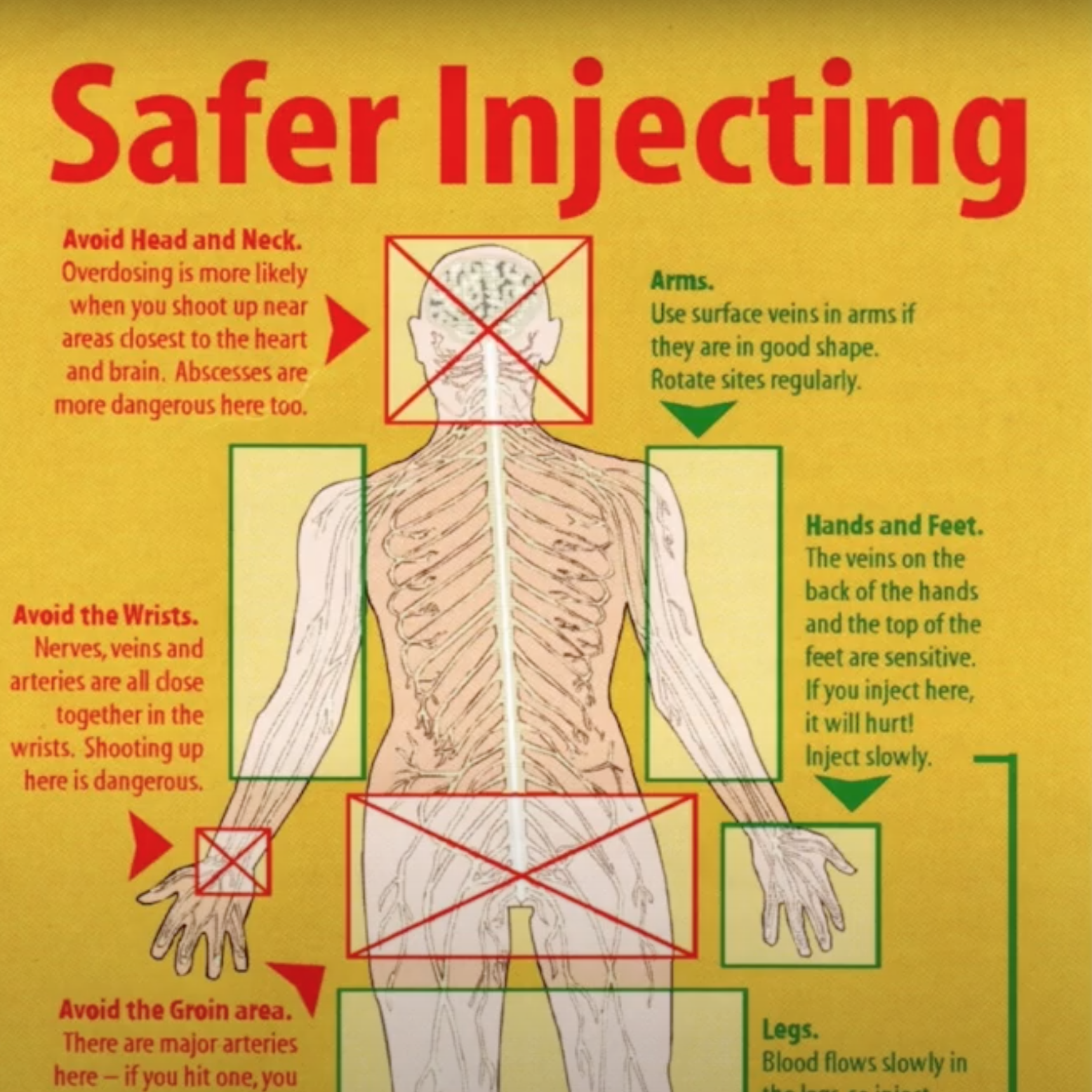 Planning for Injection