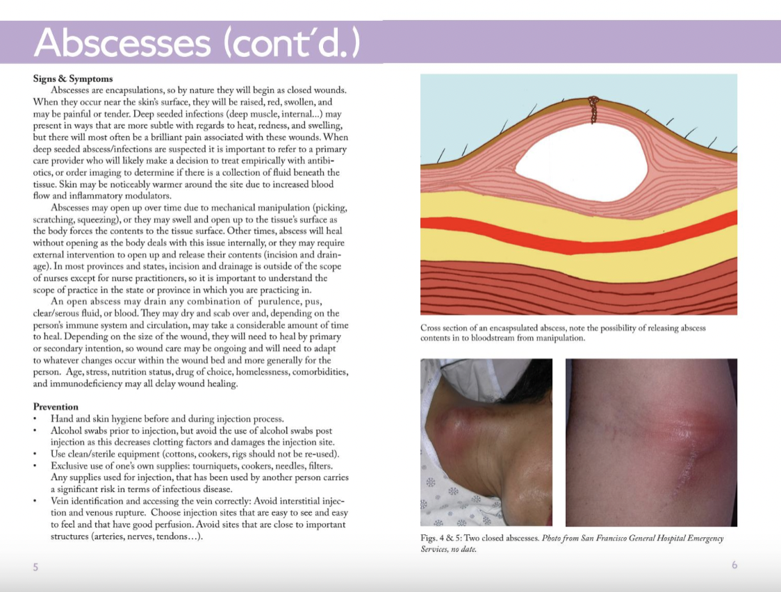 Assessing and Understanding Common Wounds