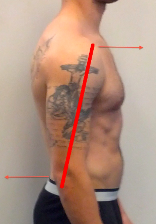 The head of the humerus is pushed forward