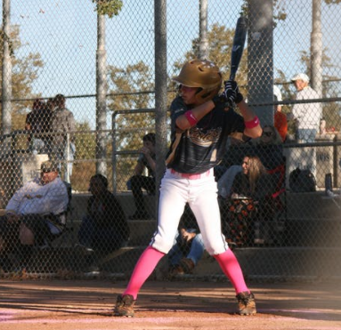 Slipped Capital Femoral Epiphysis: The Underlying Mechanism for FAI?&nbsp;