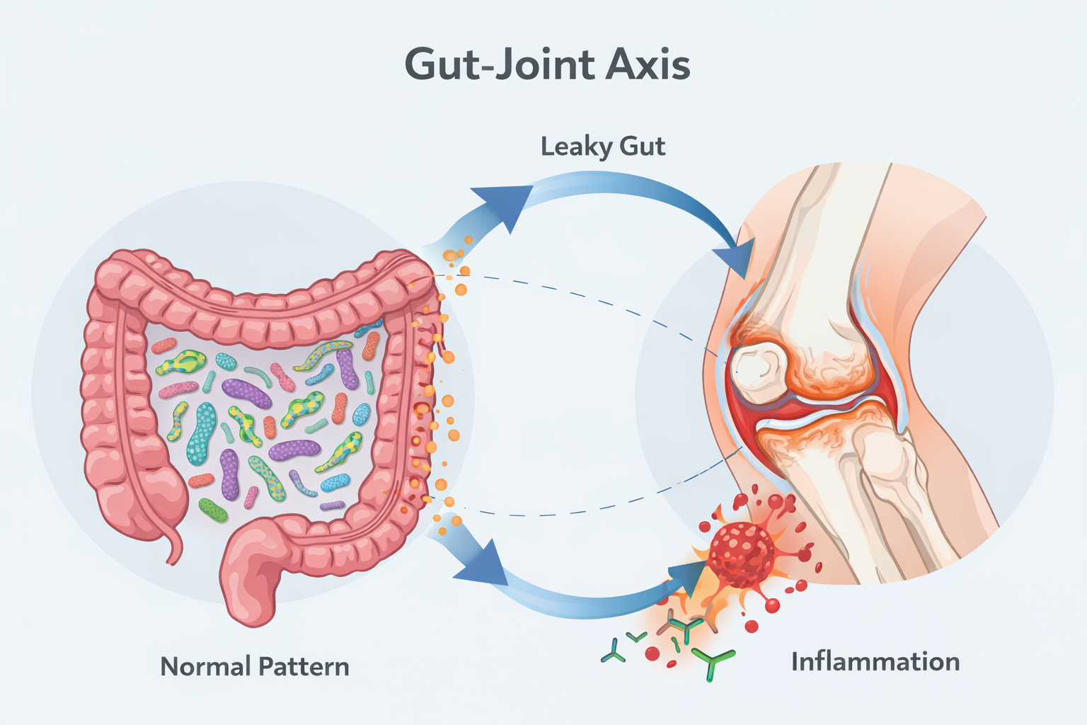 The Gut-Joint Axis
