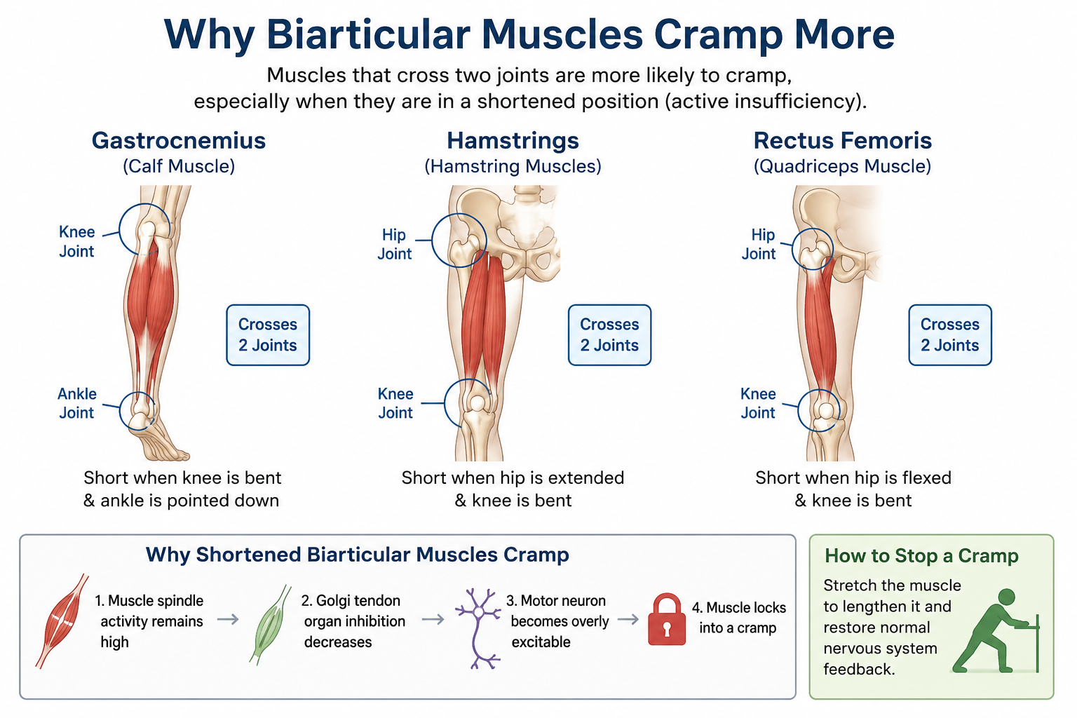 Why Do Hamstrings and Calves Cramp?