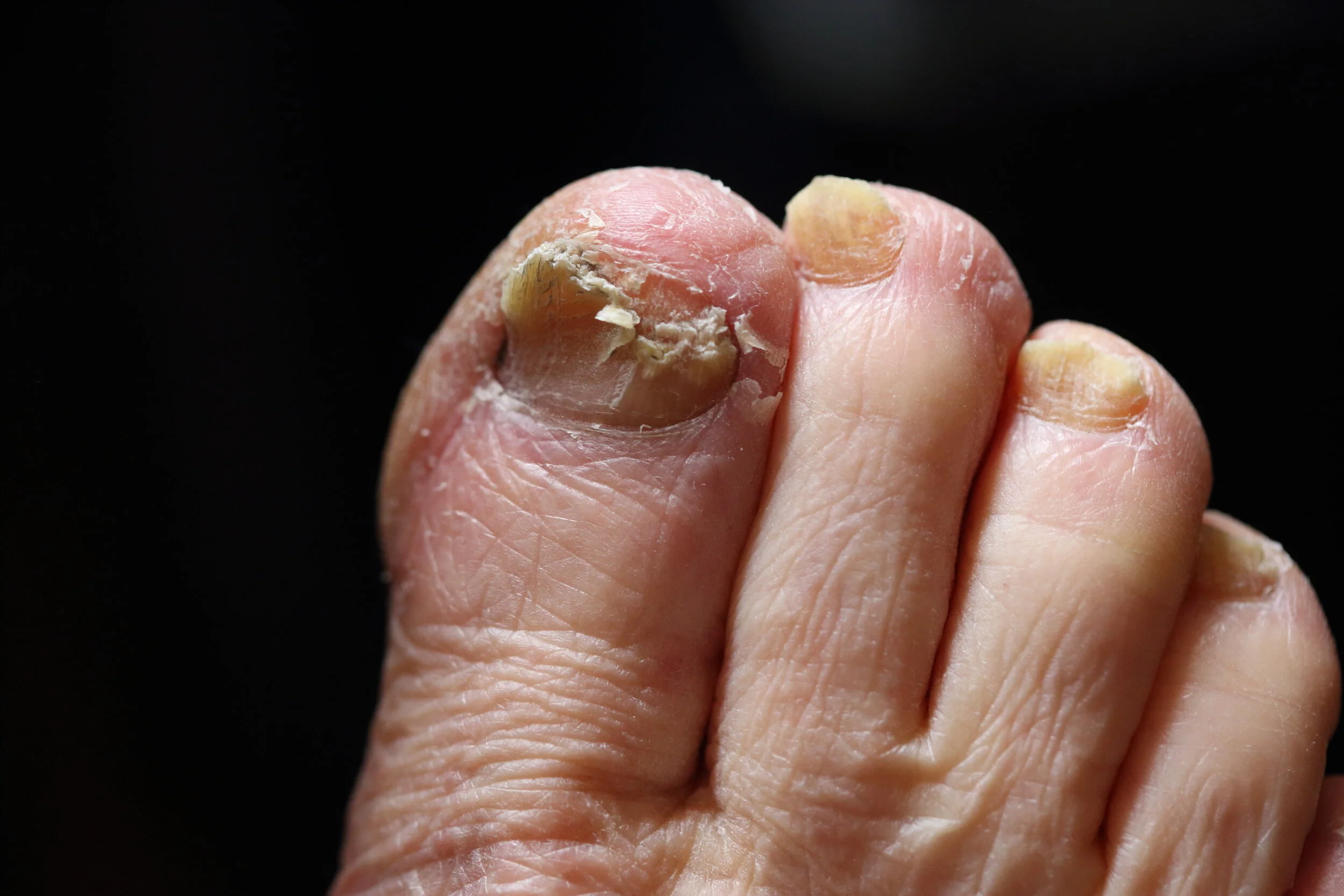 Robert Zimmerman.JPG