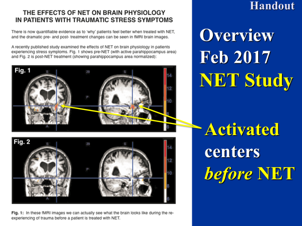 NETMRI.png