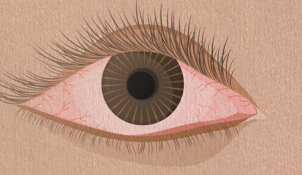 cha_eye.jpg