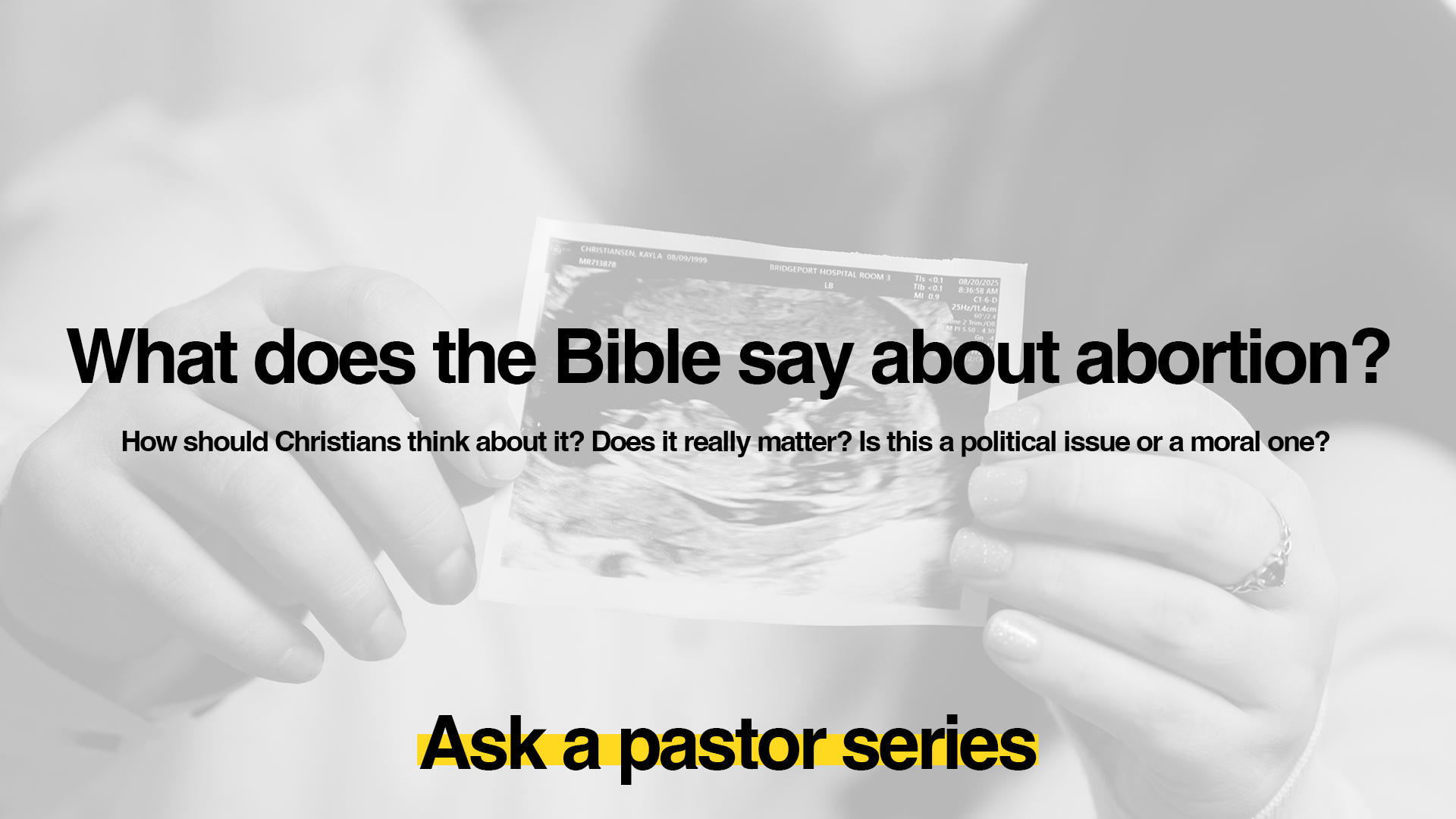 Ask a Pastor: What does the Bible say about abortion? 