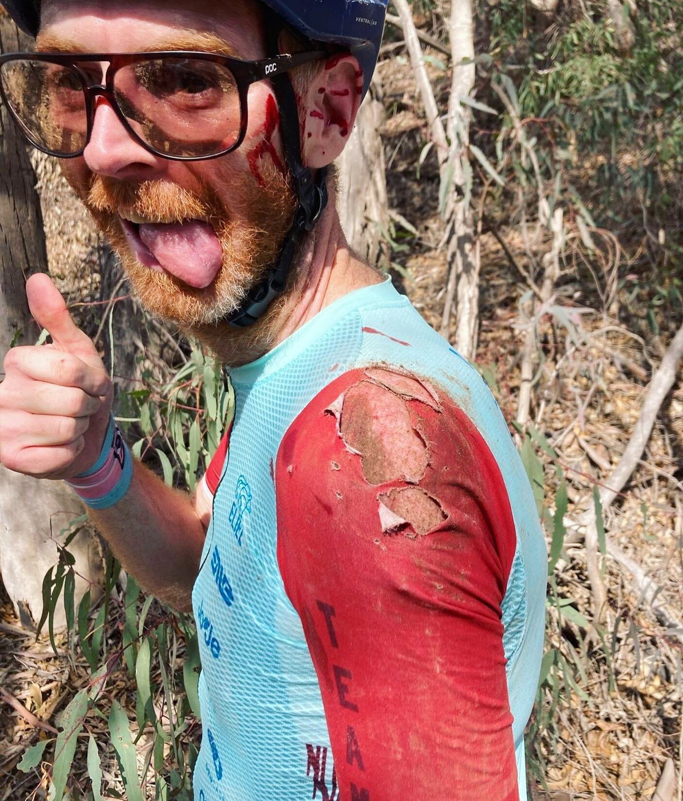 You should see the other guy.

#overthebars 
#newkitday 
#gravelstoke 
#explorebybike 
#shredthegnar