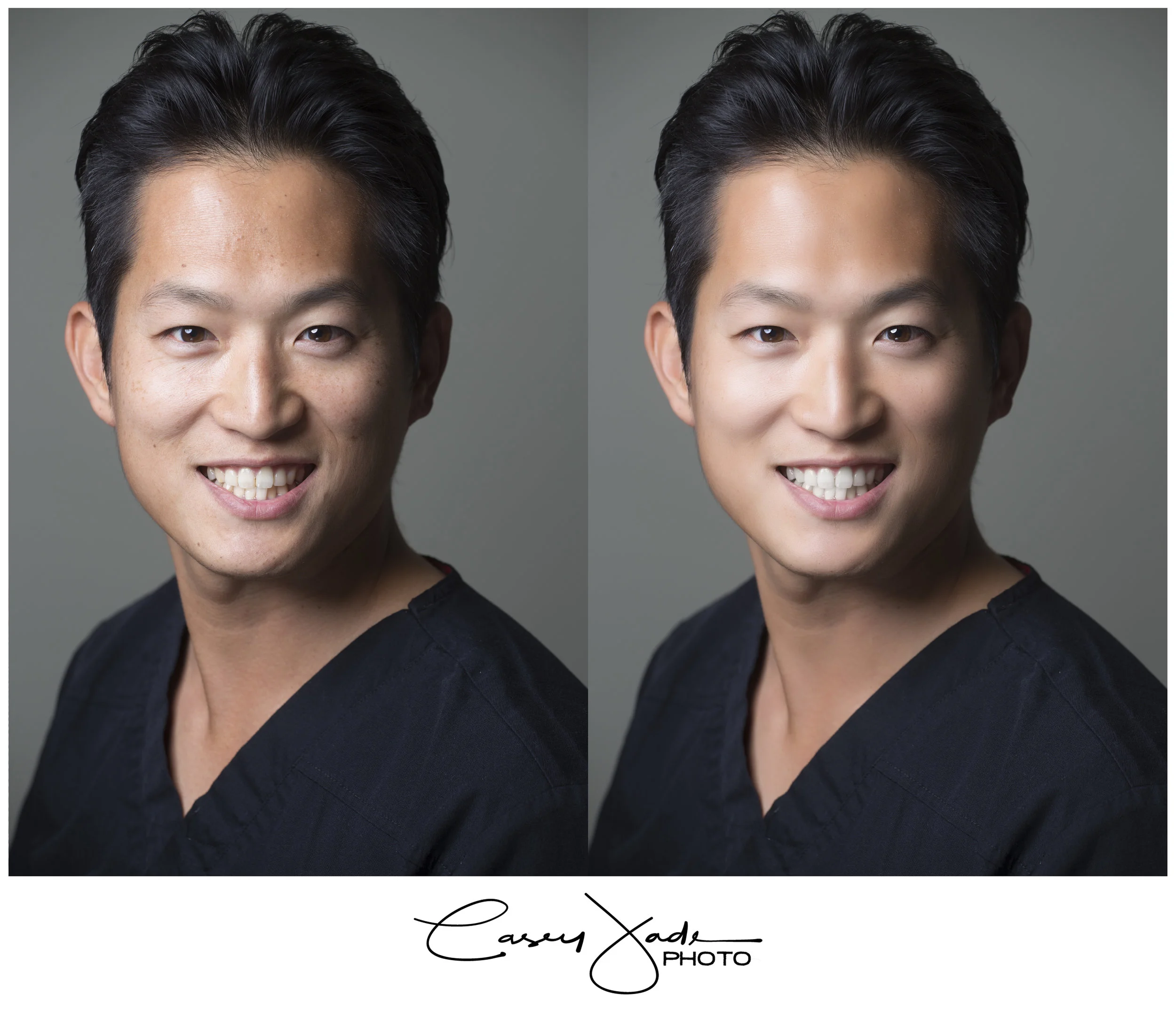 anthemmalebeforeafter-1024x880.jpg