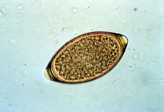 A Trichuris egg