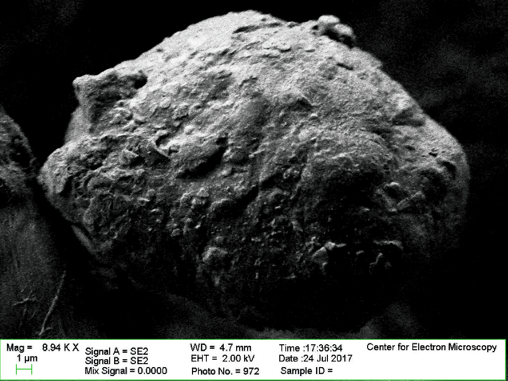 An SEM image of a silicified T. suis egg at 9000x magnification