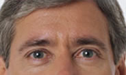 before2.png