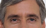 after2.png