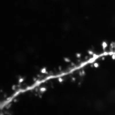 Dendritic spines in a pyramidal neuron from the visual cortex of mouse (image provided by Dr. Roberto Araya)