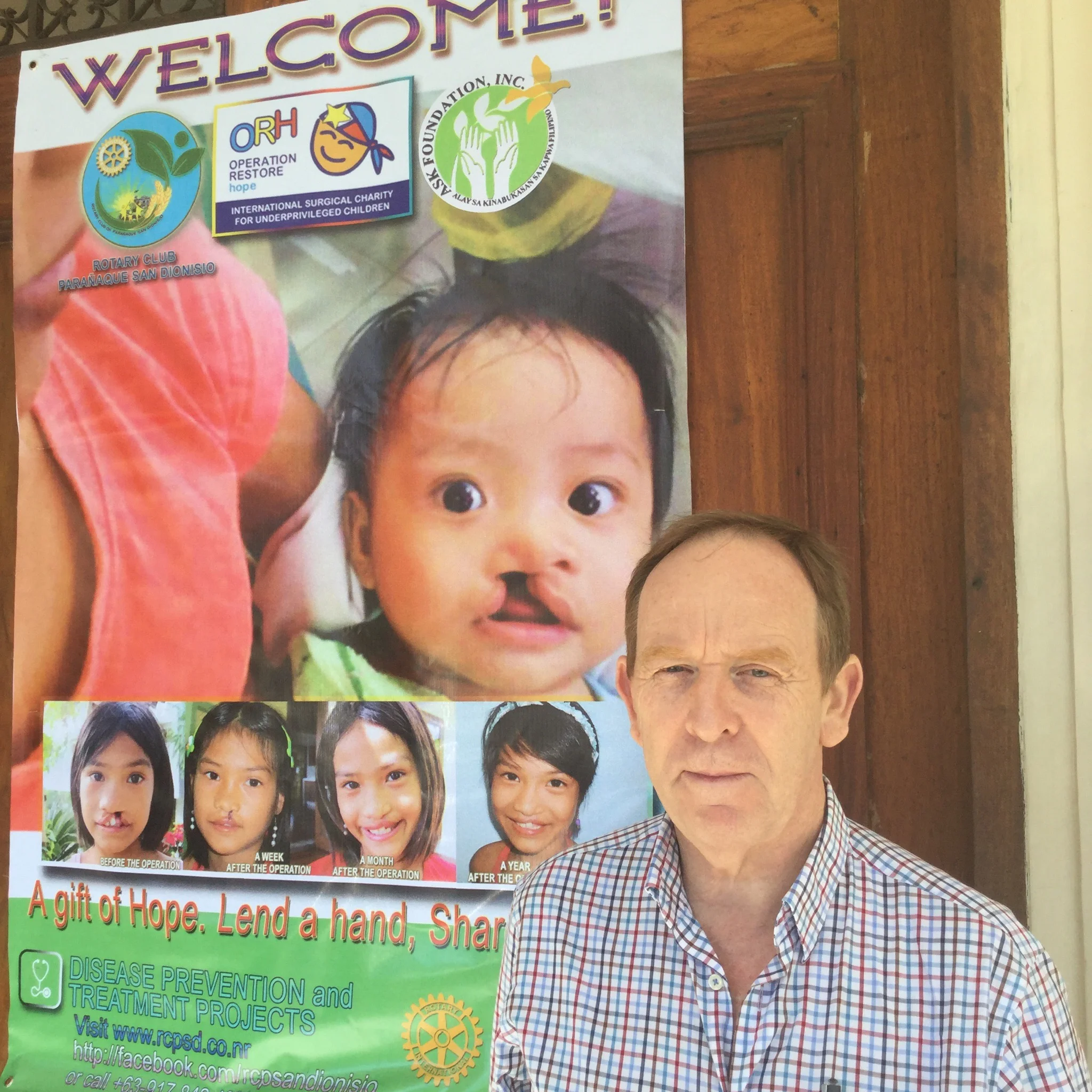 John Kinsella (above) at Manila Hospital where Operation Restore Hope (International NGO) are operating on underprivileged children and teenagers with cleft palate. 