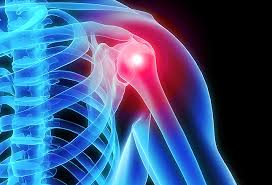 shoulder 4.jpeg