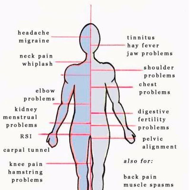 Bowen Therapy treats a whole range of problems call 07921839552 and see what it can do for you . #bordersbowenhealth kelso or Galashiels. Also home visits are available.