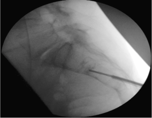 20161205151727914_300_233_1_0.png