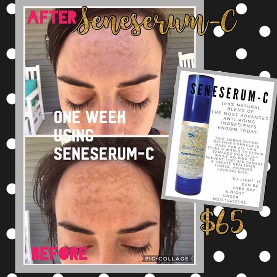 SeneSerum C Before and After