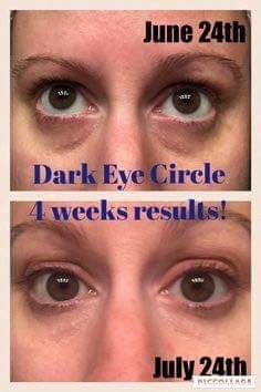SeneDerm Solutions Dark Circle Eye Treatment Reviews