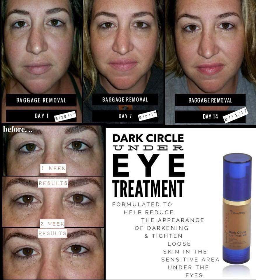 SeneDerm Solutions Dark Circle Eye Treatment Review