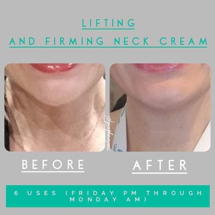 firming cream before and after