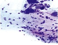 Mon chat pourrait-il avoir des parasites ?