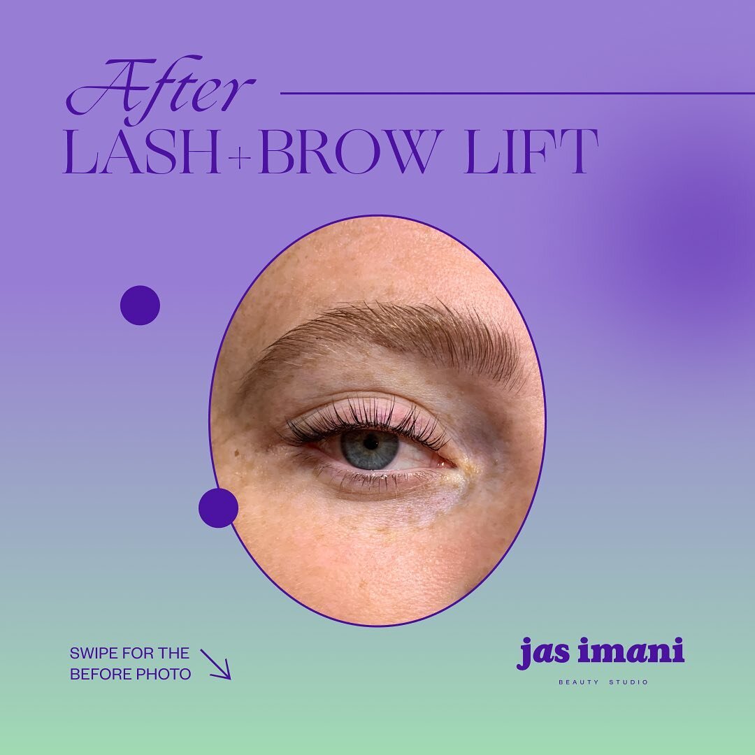 A Brow Lift is also known as Brow Lamination.  This treatment will shape and keep your brows hair in place. ⁠⁠
⁠⁠
Hit us with your brow questions below👇🏾
⁠⁠
#LiftsbyJas⁠⁠
⁠⁠
S W I P E for before...⁠⁠
:⁠⁠
:⁠⁠
:⁠⁠
:⁠⁠
:⁠⁠
:⁠⁠
#beauty #beautyjunkies #