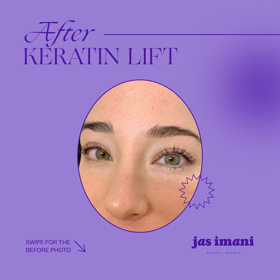 Keratin Lash Lift: with this treatment there are no false lashes attached &amp; no harmful adhesives used.⁠⁠
⁠⁠
We start by lifting your lashes onto a silcone shield and shaping them out according to your eye shape...⁠⁠
⁠⁠
⁠⁠
S W I P E for before...⁠