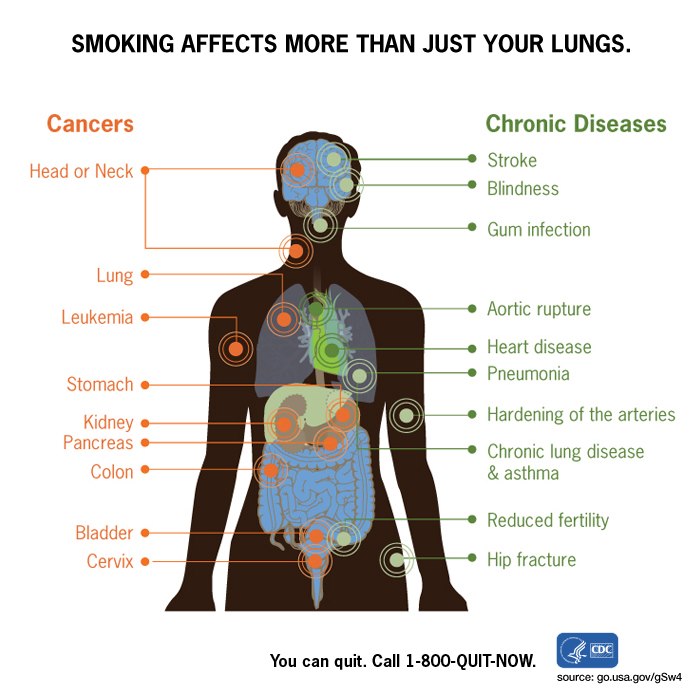 SmokeHurts.jpg